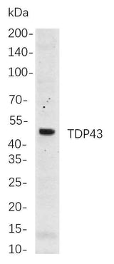 Anti-Human/Mouse/Rat TDP43 Antibody [B714]