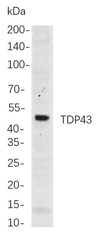 Anti-Human/Mouse/Rat TDP43 Antibody [B714] - ABMIUM