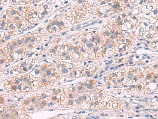 Anti-Human/Mouse/Rat G6PC Antibody