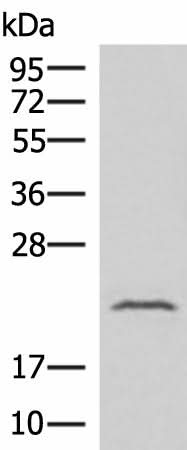 Western blot analysis of Human fetal liver tissue lysate using IFNA8 Polyclonal Antibody at dilution of 1:500