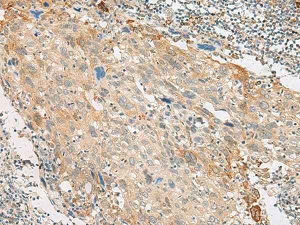 Anti-Human GPR151 Antibody