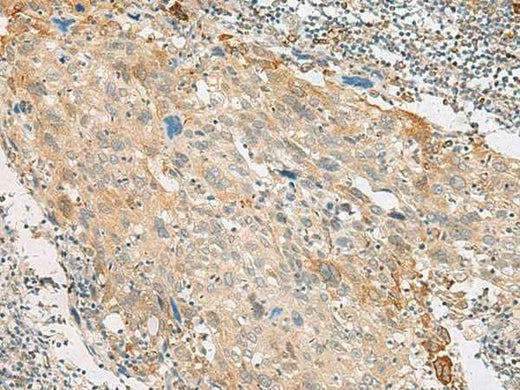 Anti-Human GPR151 Antibody