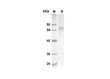 SDS-PAGE analysis of Mouse Crtam proteins, 2 μg/lane of Recombinant Mouse Crtam proteins was resolved with an SDS-PAGE under reducing conditions, showing bands at 29.9 kDa.