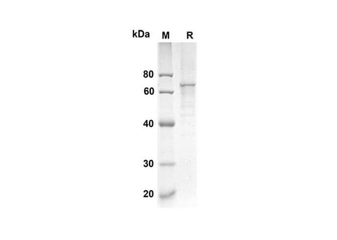 SDS-PAGE analysis of Mouse Crtam proteins, 2 μg/lane of Recombinant Mouse Crtam proteins was resolved with an SDS-PAGE under reducing conditions, showing bands at 29.9 kDa.