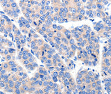 Anti-Human/Mouse/Rat KCNH8 Antibody - ABMIUM