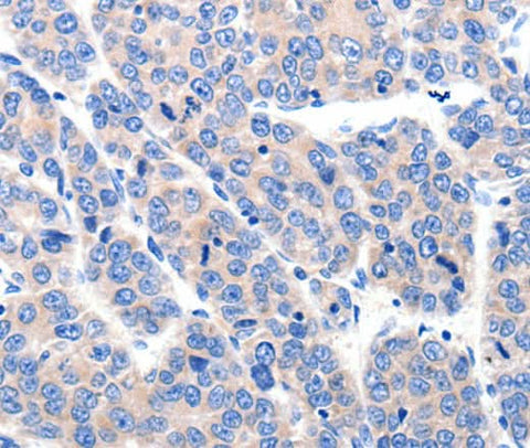 Anti-Human/Mouse/Rat KCNH8 Antibody - ABMIUM