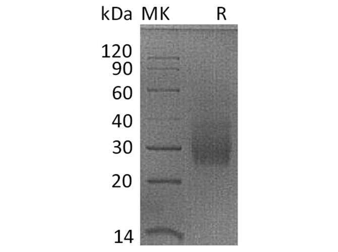 Recombinant Rhesus macaque HVEM/TNFRSF14/CD270 Protein (His Tag) - ABMIUM