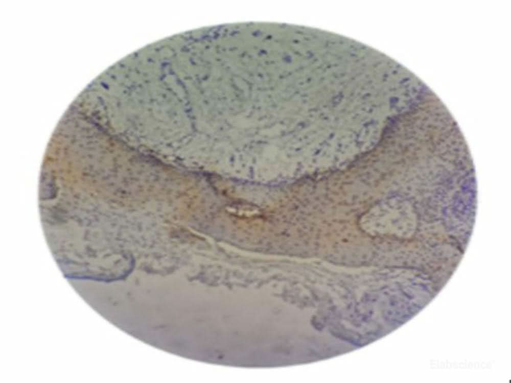 Immunohistochemistry of P.gingivalis.