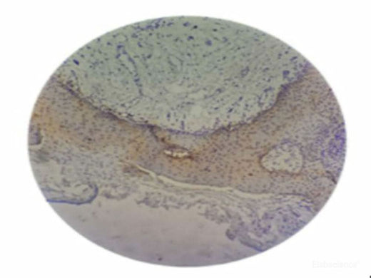 Immunohistochemistry of P.gingivalis.