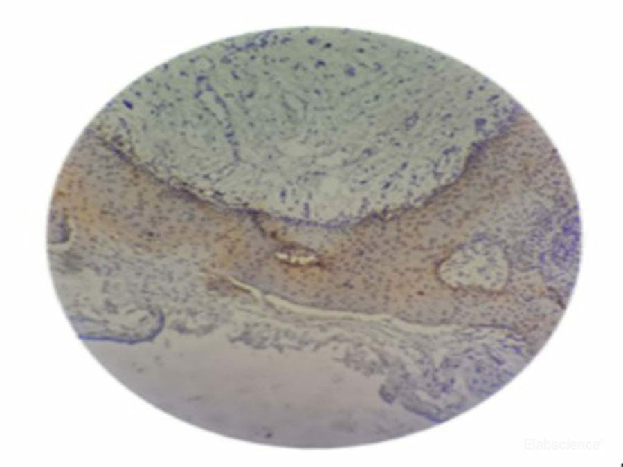Immunohistochemistry of P.gingivalis.