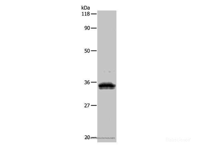 Anti-Human UPK3B Antibody - ABMIUM