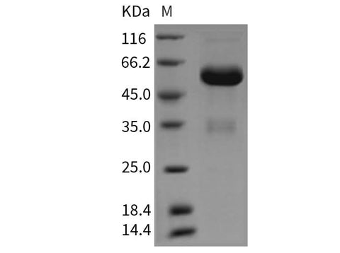 Recombinant Rat Layilin/LAYN Protein (Fc Tag) - ABMIUM
