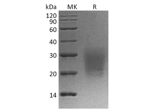 Recombinant Cynomolgus CD3d/CD3 delta Protein (His Tag) - ABMIUM