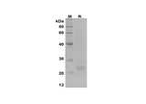 SDS-PAGE analysis of SARS-CoV-2 E proteins, 2 μg/lane of Recombinant SARS-CoV-2 E proteins was resolved with SDS-PAGE under reducing conditions, showing bands at 24 kDa.