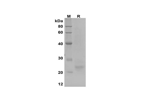 SDS-PAGE analysis of SARS-CoV-2 E proteins, 2 μg/lane of Recombinant SARS-CoV-2 E proteins was resolved with SDS-PAGE under reducing conditions, showing bands at 24 kDa.