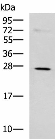 Western blot analysis of K562 cell lysate using NQO2 Polyclonal Antibody at dilution of 1:650