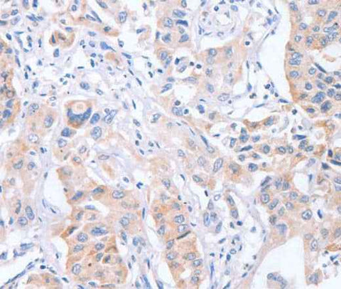 Anti-Human/Mouse CDCA4 Antibody