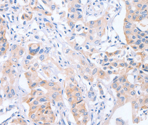Anti-Human/Mouse CDCA4 Antibody - ABMIUM