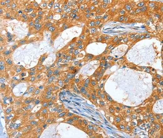 Anti-Human/Mouse/Rat AMHR2 Antibody