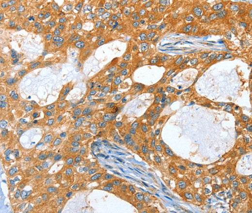 Anti-Human/Mouse/Rat AMHR2 Antibody - ABMIUM