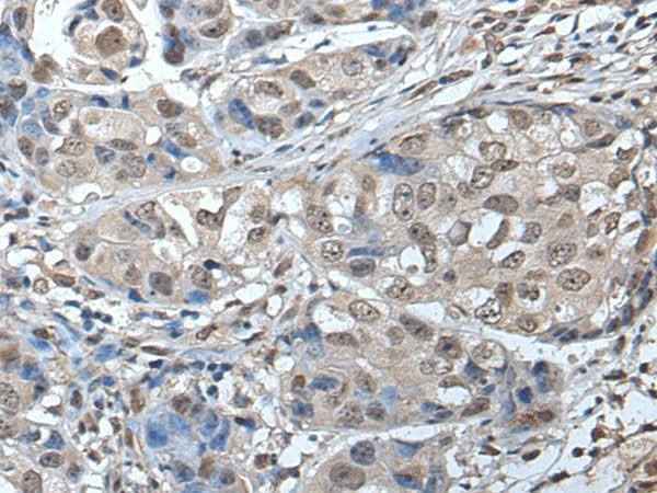 Anti-Human/Mouse/Rat SMC1A Antibody