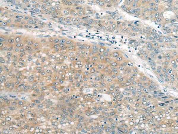 Anti-Human/Mouse UBE2G2 Antibody