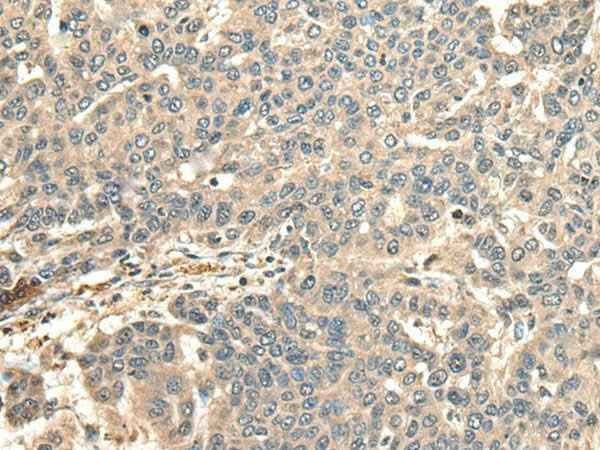 Anti-Human/Mouse CCDC113 Antibody