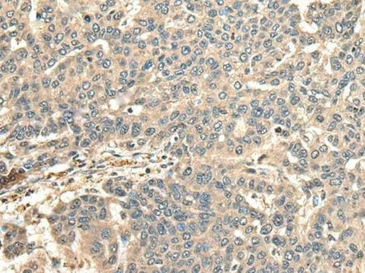 Anti-Human/Mouse CCDC113 Antibody