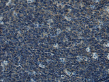 Immunohistochemistry of paraffin-embedded Human tonsil tissue using CUL5 Polyclonal Antibody at dilution of 1:55(×200)