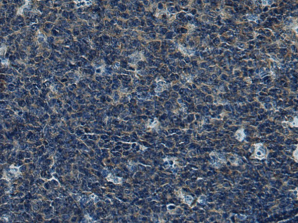 Immunohistochemistry of paraffin-embedded Human tonsil tissue using CUL5 Polyclonal Antibody at dilution of 1:55(×200)