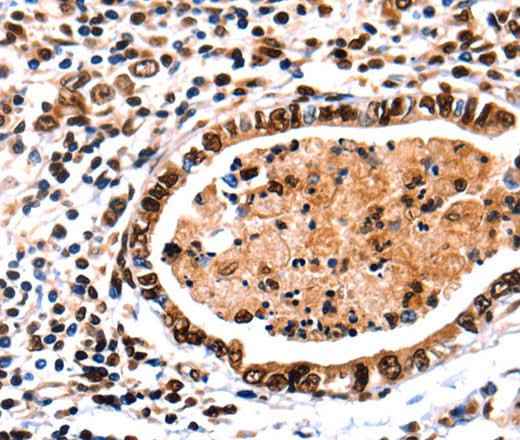Anti-Human/Mouse/Rat DNMT3A Antibody