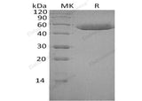 Recombinant Human SerpinF1/PEDF Protein (His Tag) - ABMIUM