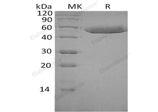 Recombinant Human SerpinF1/PEDF Protein (His Tag) - ABMIUM