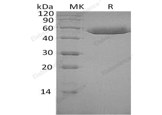 Recombinant Human SerpinF1/PEDF Protein (His Tag) - ABMIUM