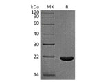 Recombinant Rhesus macaque IL-33/Interleukin-33 Protein (His Tag) - ABMIUM
