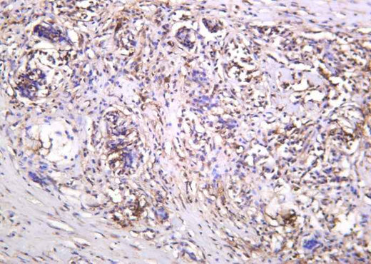 Anti-Human/Mouse/Rat Thioredoxin Antibody [B1017] - ABMIUM