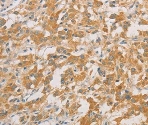 Anti-Human ZWINT Antibody