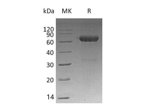 Recombinant Mouse MMP12/MMP-12/HME Protein (His Tag) - ABMIUM