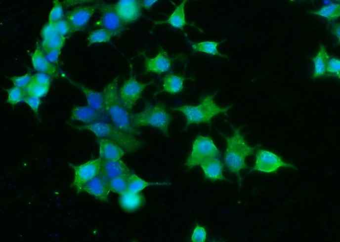 Anti-Human CNDP1 Antibody [A1236] - ABMIUM