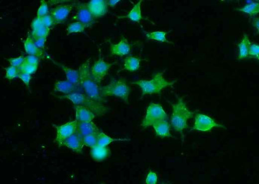 Anti-Human CNDP1 Antibody [A1236] - ABMIUM