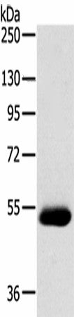 Western blot analysis of Human breast infiltrative duct tissue using SERINC4 Polyclonal Antibody at dilution of 1:200