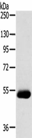 Western blot analysis of Human breast infiltrative duct tissue using SERINC4 Polyclonal Antibody at dilution of 1:200