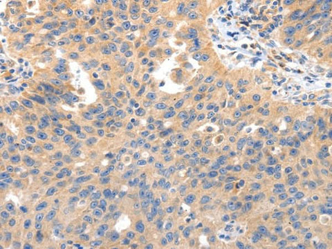 Anti-Human/Mouse IRS2 Antibody - ABMIUM