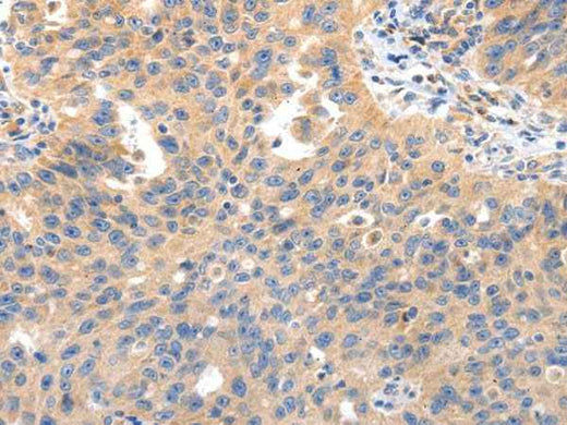 Anti-Human/Mouse IRS2 Antibody - ABMIUM