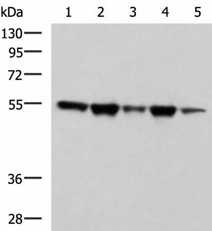 Anti-Human FKBP5 Antibody - ABMIUM
