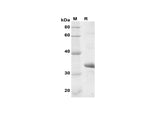 SDS-PAGE analysis of Human Mfn2 proteins, 2 μg/lane of Recombinant Human Mfn2 proteins was resolved with SDS-PAGE under reducing conditions, showing bands at 34 kDa.