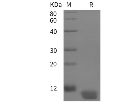 SDS-PAGE analysis of Human CRH proteins, 2 μg/lane of Recombinant Human CRH proteins was resolved with SDS-PAGE under reducing conditions, showing bands at 10 kDa.