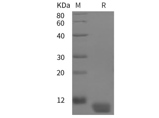 SDS-PAGE analysis of Human CRH proteins, 2 μg/lane of Recombinant Human CRH proteins was resolved with SDS-PAGE under reducing conditions, showing bands at 10 kDa.