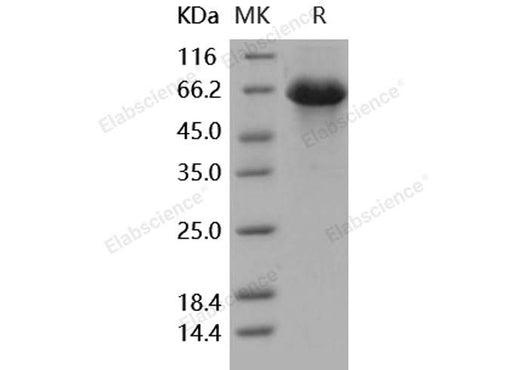 Recombinant Human SerpinD1 Protein (His Tag) - ABMIUM
