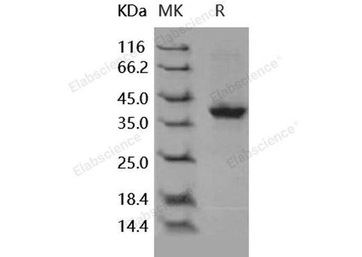 Recombinant Human S100A2 Protein (Fc Tag) - ABMIUM
